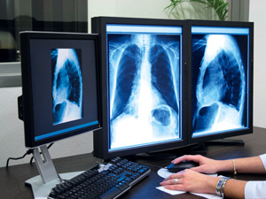 Akciğer röntgeninin sonuçları üç monitörde gösteriliyor