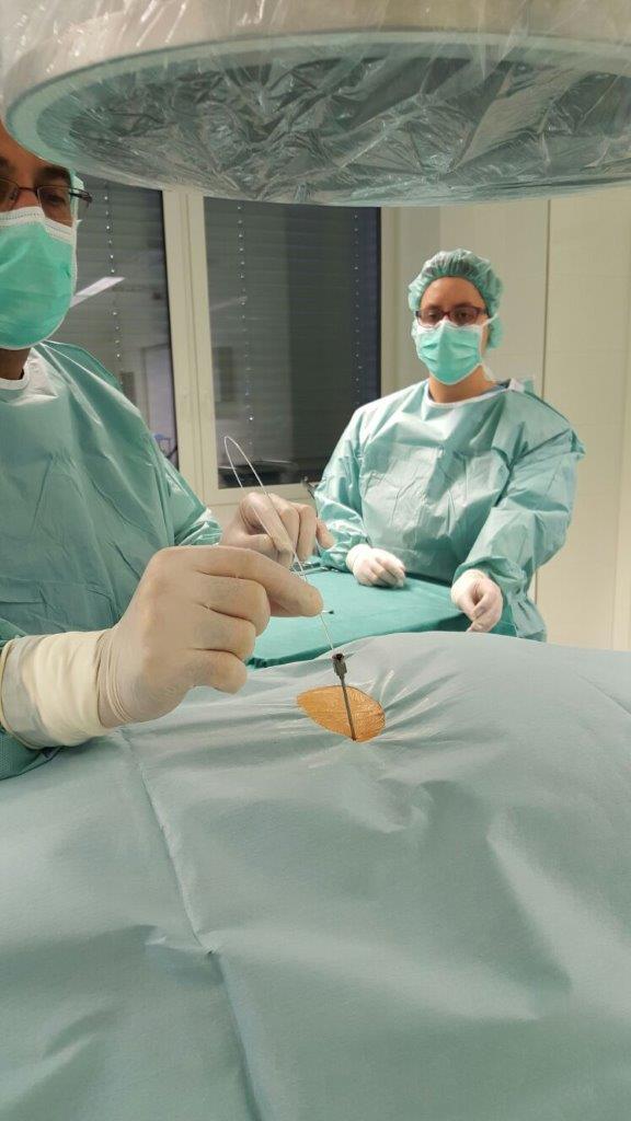 Zwei Chirurgen bei der Denervation von Wirbelgelenken